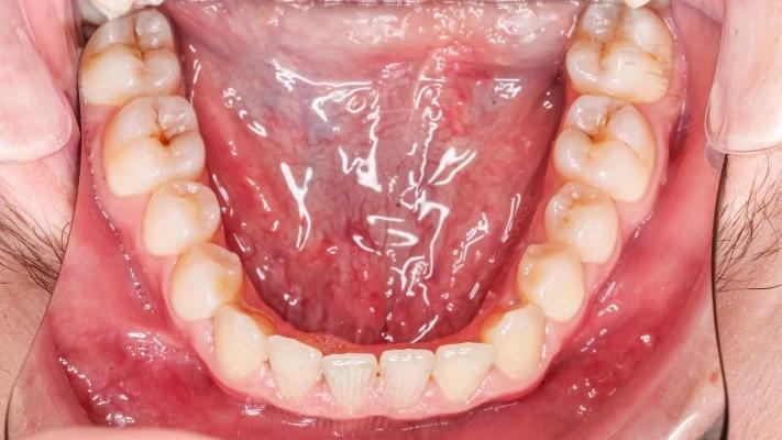 Исследование, изучающее взаимодействие мезенхимальных стволовых клеток на лингвальной стороне в процессе формирования зуба