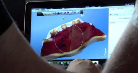 Технология трехмерного голографического сканирования ускоряет процесс установки зубного протеза
