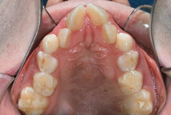 Основы профилактической ортодонтии