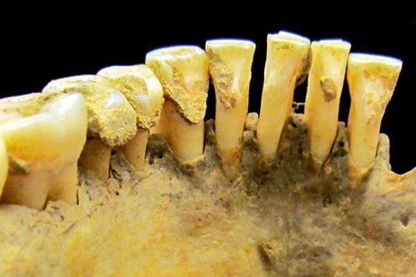 Нашли способ определять пол останков древних людей по анализу зубов
