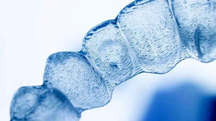 Вертикальный контроль при коррекции открытого прикуса с помощью элайнеров и каркасного крепления