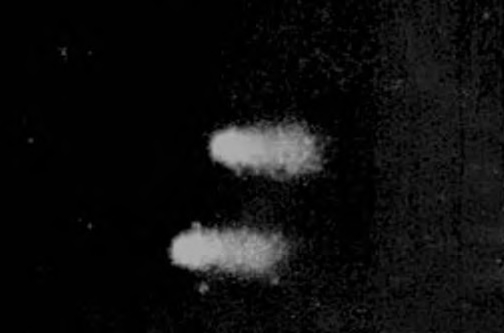 Изображение &quot;комет&quot; в мышиных фибробластах, обработанных ортодонтическим цементом. Окраска Syber green, x40.