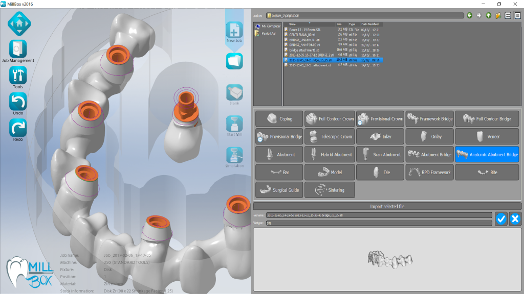 Программа для стоматологии. CAD cam стоматология программа. MILLBOX программа. MILLBOX Roland. CAD cam для светильников.