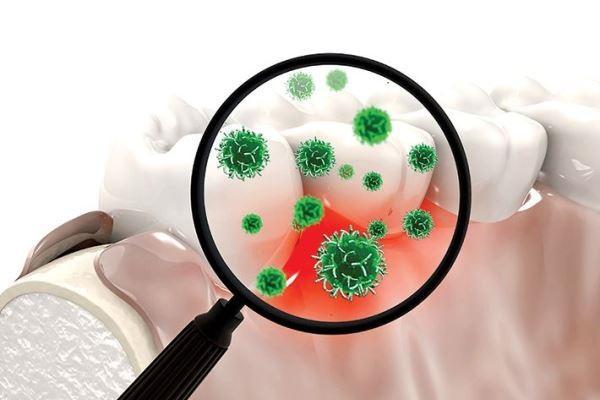 Бактерии полости рта могут быть связаны с болезнью Паркинсона