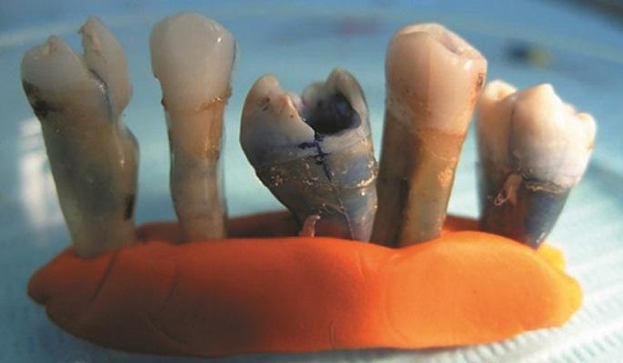 Сравнительная характеристика эффективности инструментальной обработки зубов с С-образной системой корневых каналов