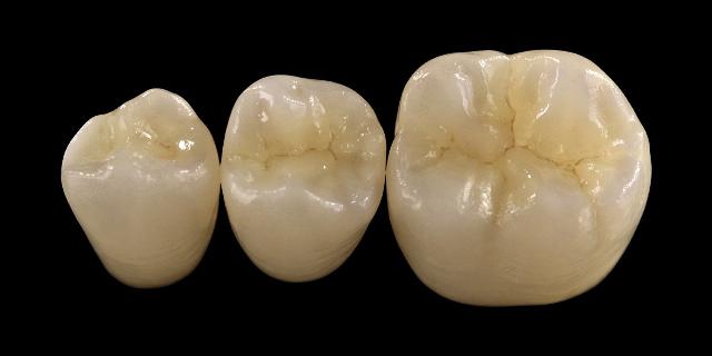 Zirkonzahn’s Prettau Zirconia