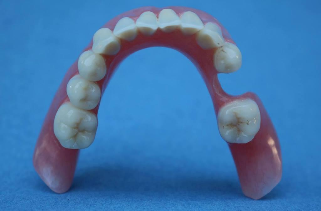 Съемный протез на 2 зуба фото