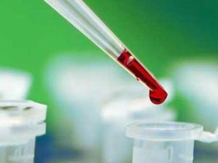Новый анализ крови поможет в диагностике рака полости рта