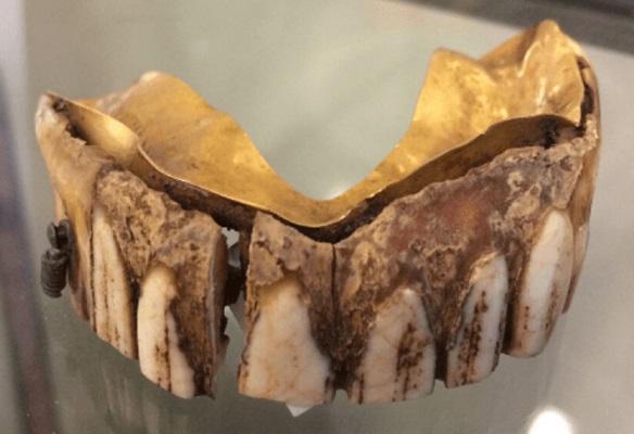 На аукционе выставили зубной протез из золота и бегемотовой кости, который оценили в 9 тысяч долларов