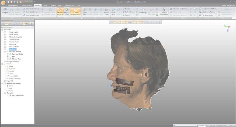 Компьютерное моделирование зубов при лечении