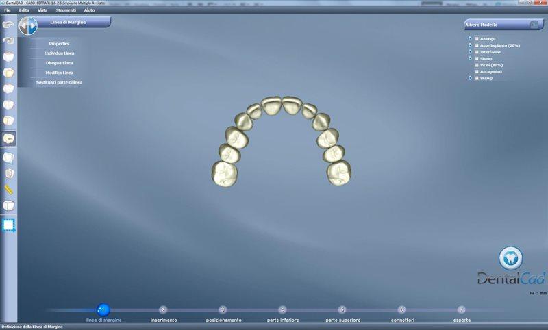 Компьютерное моделирование зубов при лечении