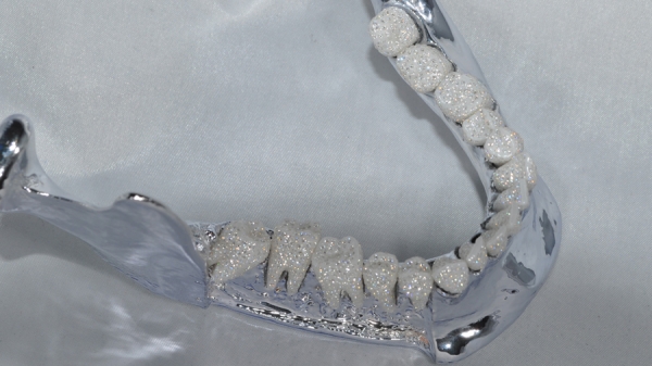 Precious Bones (драгоценные кости) - Eternal smile (Вечная улыбка) - череп с зубами, украшенными тысячами бриллиантов