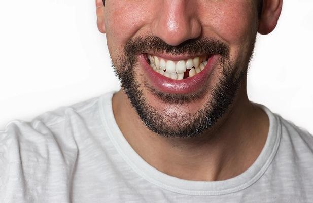 Вырастить новые зубы – мечта каждого стоматолога