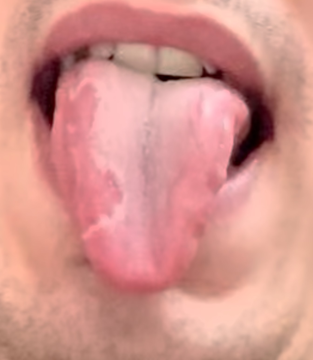 ca1572299724234b1a0efe98a507.png