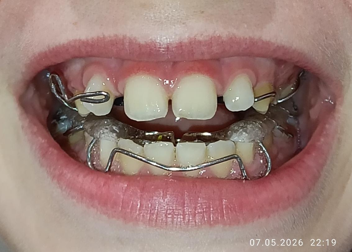 9b70dcb6777eaa858bb253baf590.jpg