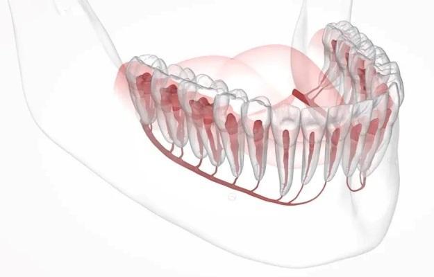 Искусственный интеллект может помочь в операции по имплантации зубов, локализуя нижнечелюстные каналы