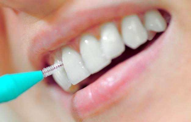 У диабетиков, практикующих чистку межзубных промежутков, наблюдается более стабильный уровень глюкозы в крови