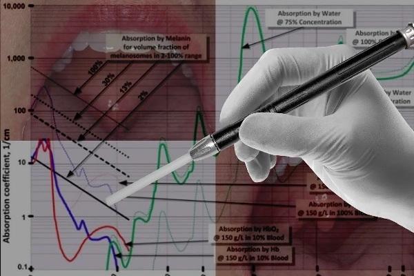 Лазеры для мягких тканей в стоматологии: новинки рынка для врачей