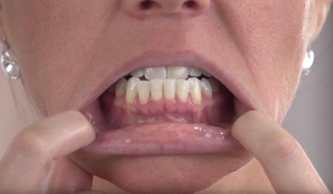 Разработан новый ПЦР-тест для диагностики рака полости рта