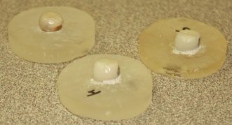 Эстетические коронки из нержавеющей стали, установлены на зуботехнические штампы из эпоксидной смолы. Слева направо: EC crown (Dental Innovations), Kinder Krowns и NuSmile Primary Crowns