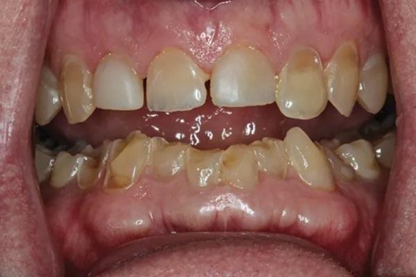 Планирование лечения с правильным функциональным диагнозом: разрушение мифов