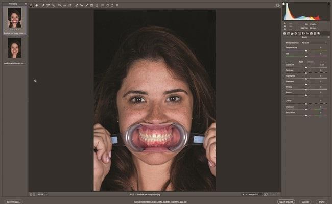 Цифровой анализ улыбки в Photoshop