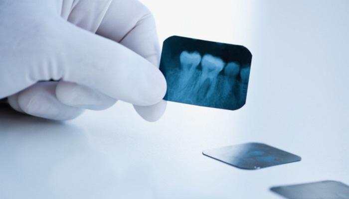 Кто имеет право делать рентгеновские исследования в стоматологической клинике?