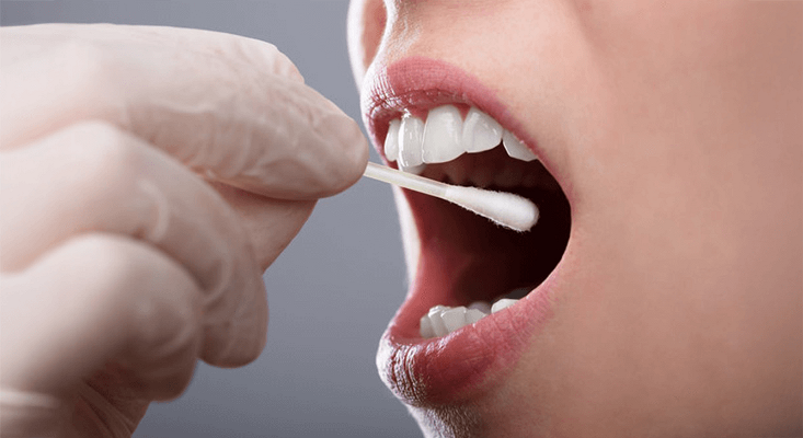 Биомаркеры слюны указывают на связь между пародонтитом и риском развития метаболического синдрома