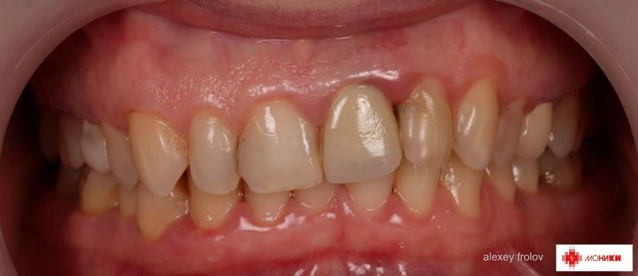 Малоинвазивные методы реабилитации на амбулаторном стоматологическом приеме