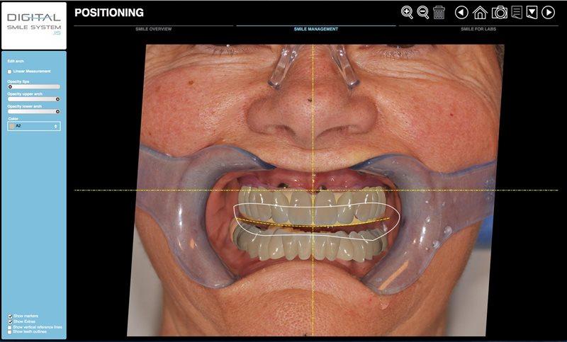 3d моделирование зубов программа скачать