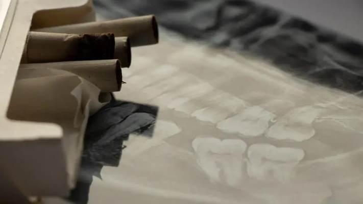 Особенности роста зубов связаны с историей курения